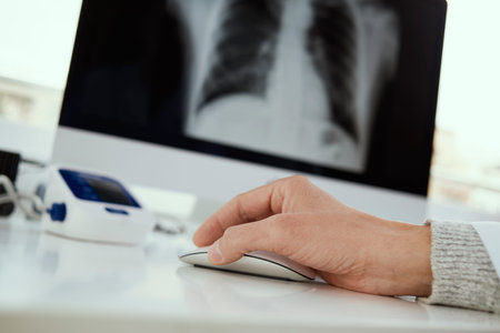 closeup of a young doctor man sitting at his desk checking a chest radiograph in his computer