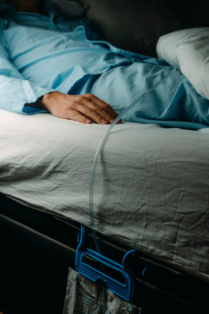 a man, in a blue pajamas, wears a urinary catheterization connected to a drainage bag lying face up in bedの写真素材