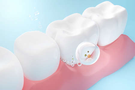Bubble of toothpaste or mouthwash clean food stuck between teeth. Tooth care and Oral healthy concept.の写真素材