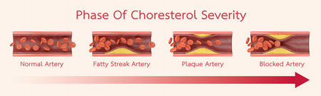 Types of blood vessels in the blood. Vector illustration on a white background.の写真素材