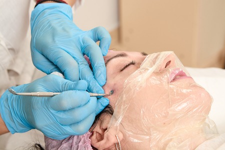 Young woman in beauty salon does manual face cleaning. Manual removal of pimple, acne, blackhead, purulent furuncle on the face. Medical and beauty equipment healthcare. Face professional massage.の写真素材