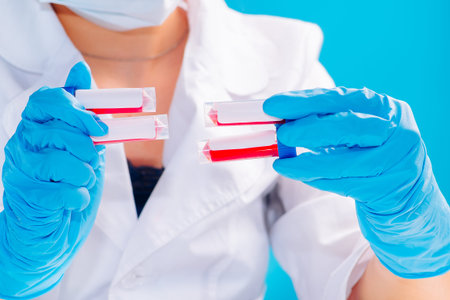 The biochemist holds a test tube with a blood sample in his hands.Coronavirus pandemic...