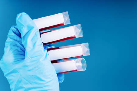 The biochemist holds a test tube with a blood sample in his hands.Coronavirus pandemic stop.Pharmacology.Chemical laboratory.Control of the composition of drugs. Development of new vaccines.の写真素材