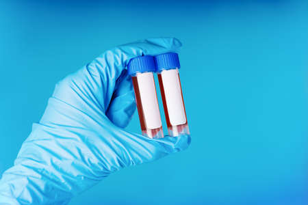 The biochemist holds a test tube with a blood sample in his hands.Coronavirus pandemic stop.Pharmacology.Chemical laboratory.Control of the composition of drugs. Development of new vaccines.の写真素材