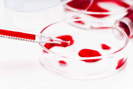 Test tubes in the laboratory close up. Blood sampling, blood test, blood infection test. Research of new devices. Pharmaceutical laboratory.の写真素材