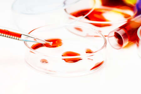 Corona Virus in Lab.Petri dish and test tubes with blood in the laboratory. Blood coronavirus test.Virus vaccine development.Medical laboratory. The concept of laboratory research. Close-up.COVID-19.の写真素材