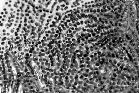 Close-up of hundreds of frog spawn