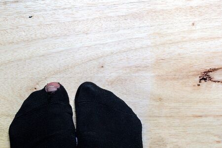 leg with a big hole in the sockの写真素材