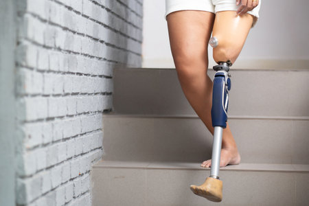Closeup leg young asian handicapper woman walking on stair at home, close-up leg woman wearing prosthetic walking on staircase, lifestyles concept.の写真素材