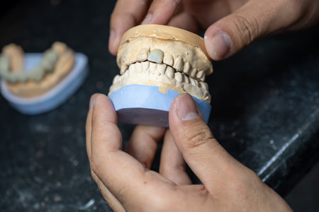 Dental gypsum models in dental laboratory with single tooth crown to be tested for Teeth occlude...