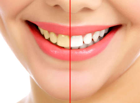 Young smiling woman, white background, copyspace. Before and after conceptsの写真素材