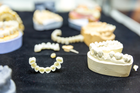 Denture treatment, dental implants closeupの写真素材