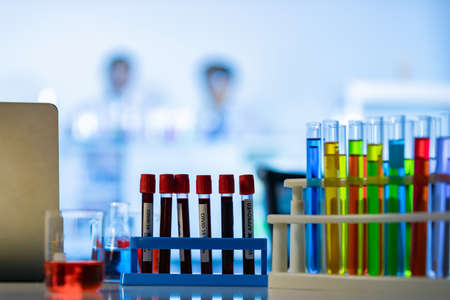Laboratory Research - Scientific glassware with blur scientist researching background.の写真素材