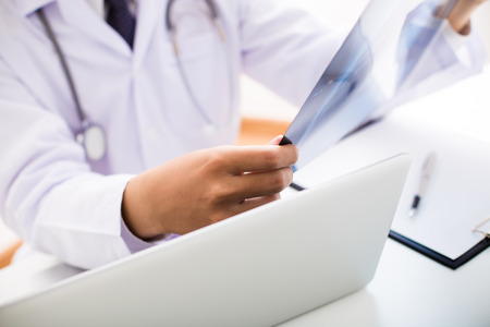 close up of male doctor holding x-ray or roentgen image