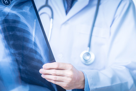 close up of male doctor holding x-ray or roentgen imageの写真素材