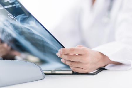 Woman Doctor Looking at X-Ray Radiography in patient's Roomの写真素材