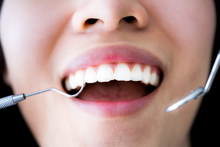 Close-up of young female having her teeth examinatedの写真素材
