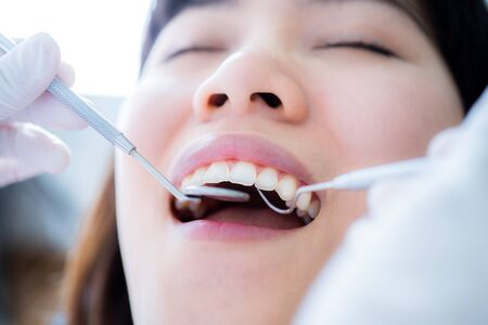 Close-up of young female having her teeth examinatedの写真素材