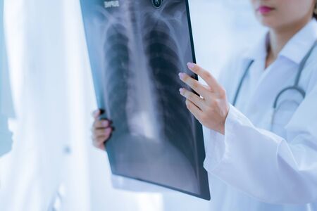 Asia Woman Doctor Looking at X-Ray Radiography in patient's Roomの写真素材
