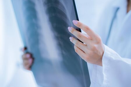 Asia Woman Doctor Looking at X-Ray Radiography in patient's Roomの写真素材