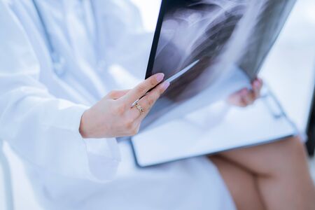 Asia Woman Doctor Looking at X-Ray Radiography in patient's Roomの写真素材