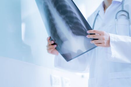 Asia Woman Doctor Looking at X-Ray Radiography in patient's Roomの写真素材