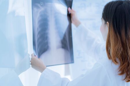 Asia Woman Doctor Looking at X-Ray Radiography in patient's Roomの写真素材