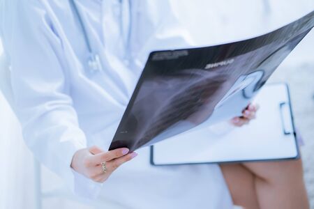 Asia Woman Doctor Looking at X-Ray Radiography in patient's Roomの写真素材