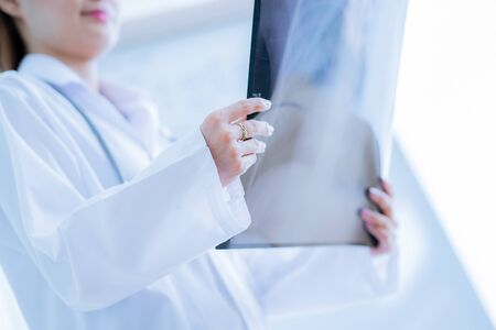 Asia Woman Doctor Looking at X-Ray Radiography in patient's Roomの写真素材