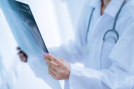Asia Woman Doctor Looking at X-Ray Radiography in patient's Roomの写真素材