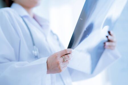 Asia Woman Doctor Looking at X-Ray Radiography in patient's Roomの写真素材