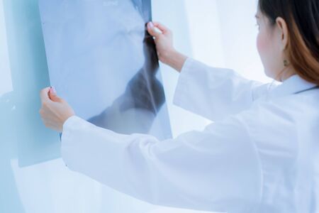 Asia Woman Doctor Looking at X-Ray Radiography in patient's Room