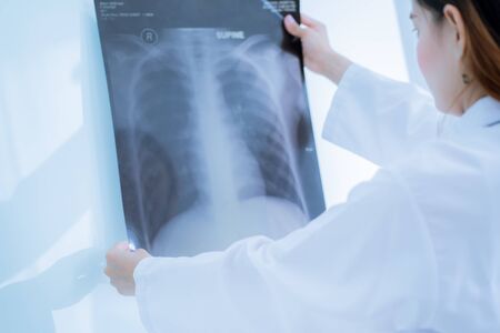 Asia Woman Doctor Looking at X-Ray Radiography in patient's Roomの写真素材
