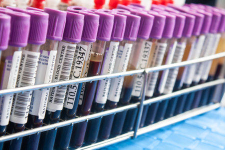 select focus tube  and rack of blood exam