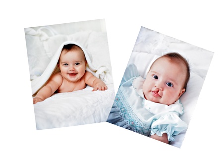 Pictures in a photo album of a baby who had surgery for a cleft lip.のeditorial素材