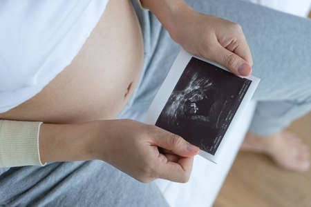 Asian pregnant woman holding ultrasound film scan of babyPregnant woman enjoy looking at ultrasound...