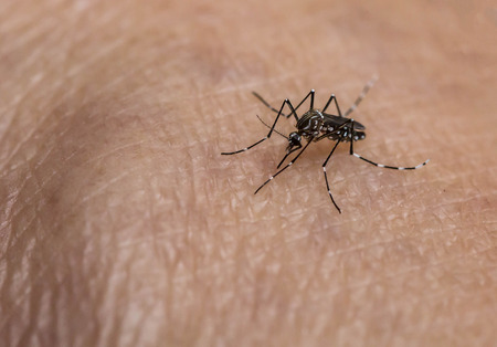 Mosquito bitesの写真素材