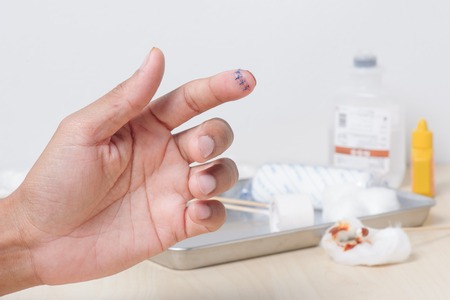 closeup wound with surgical stitchの写真素材