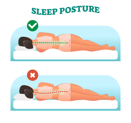 Correct and healthy sleeping posture for your neck and spine, vector illustration with sleeping female from back view. Right and wrong example.のイラスト素材