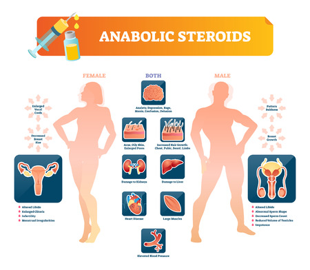 Anabolic steroids vector illustration. Health damage symptoms labeled diagram. Forbidden prescription for athletic strength and bodybuilding. Injection doping pill and dangerous synthetic stimulant.のイラスト素材