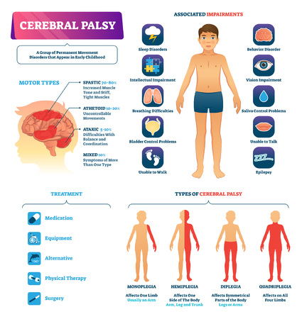 Cerebral palsy vector illustration. Labeled permanent movement disorder type scheme. Medical educational diagram with motor types, associated impairments and treatment. Special needs childhood problemのイラスト素材