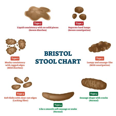 Bristol stool chart tool for faeces type classification vector illustration. Anatomical medicine diagnostic method for patient abdomen problems. Constipation and diarrhea digestive division scheme.のイラスト素材