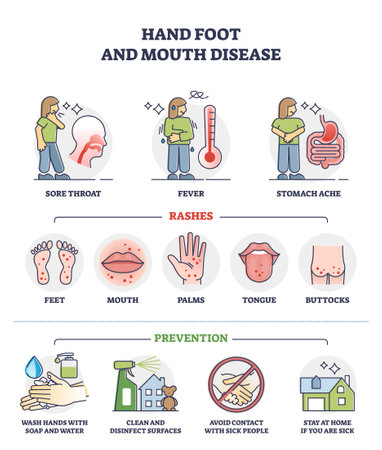 Hand, foot and mouth disease with rashes and how to avoid outline diagramのイラスト素材