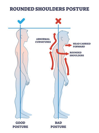 Rounded shoulders posture with body alignment forward outline diagram. Labeled educational side view scheme and good or bad example comparison vector illustration. Abnormal spine curvature deformationのイラスト素材
