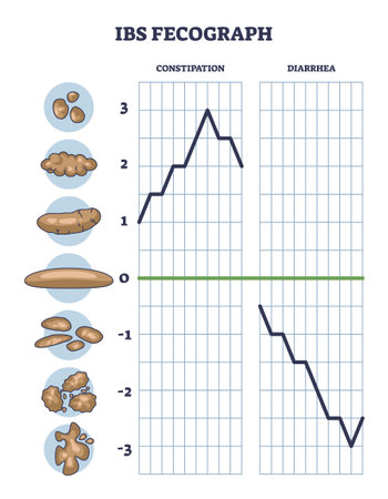 IBS fecograph as daily bristol stool form representation outline diagram. Labeled educational scheme with constipation or diarrhea diagnosis from patient excrement classification vector illustration.のイラスト素材