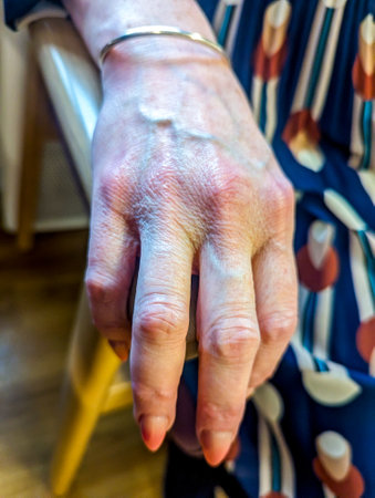 An adult female hand seen close up with the veins and skin that has lasted for many years.の写真素材
