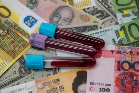 The economic situation of the world and the disease covid-19.の写真素材