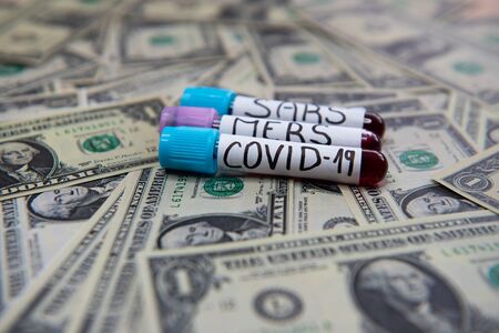 The economic situation of the dollar and the disease covid-19.