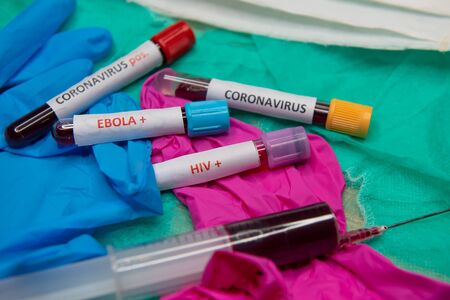 Tube with blood and positive test at coronavirus..