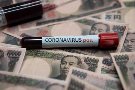 Japanese yen and positive test at coronavirus.の写真素材
